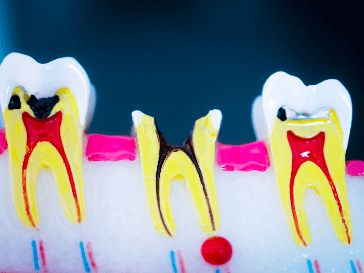 Building A Career In Restorative Dentistry